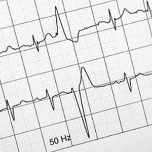 Papel para ECG Contec ECG600G rollo 110mmx20mx16I