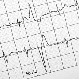Papel para ECG AR1200 rollo 120mmx20mx19E